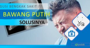 gusi-bengkak
